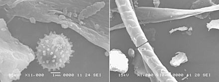 写真2　ハウスダスト試料中に見られた花粉（左）および毛髪（右）の電子顕微鏡画像